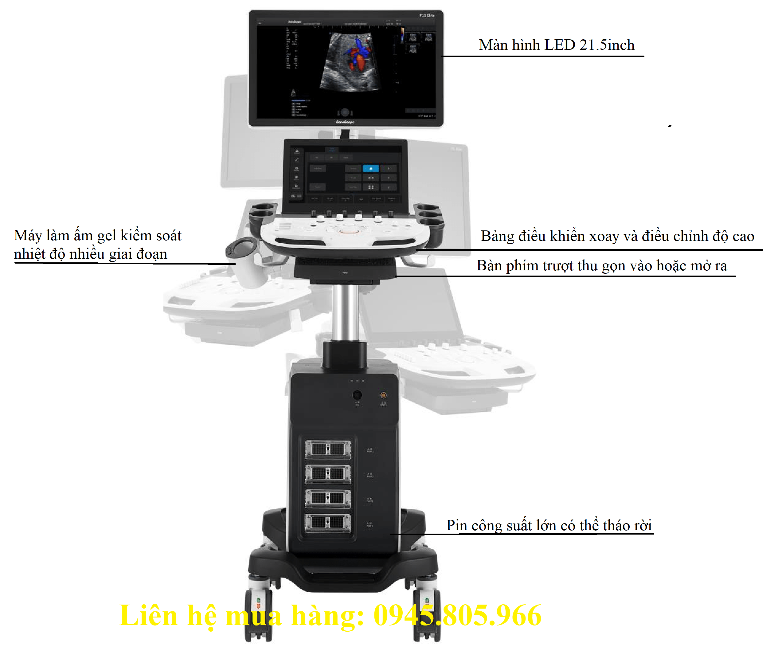 Máy siêu âm 5D SonoScape P11 Elite